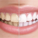 Before & After Images Comparison WordPress Plugin